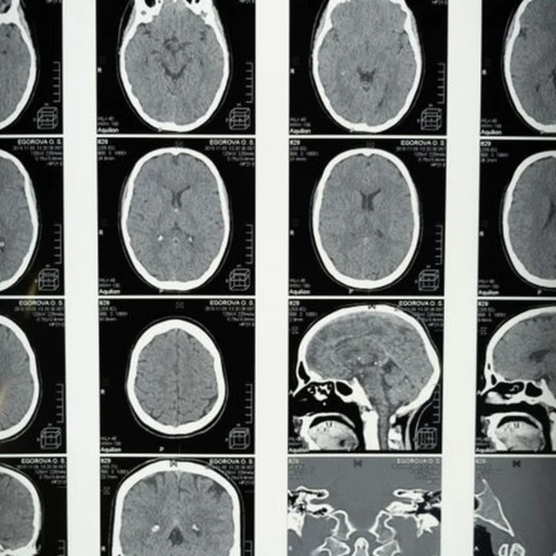 저커버그가 소비자 AI 시장을 넘어 확장하는 가운데, 메타가 소상공인용 '뮤즈' 출시 전략 분석